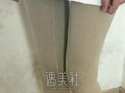 北京,八大处,吸脂