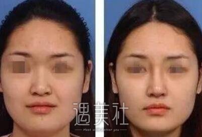 齐鲁医院美容科,公茂来