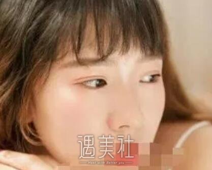 南京,军区总院美容科,割双眼皮