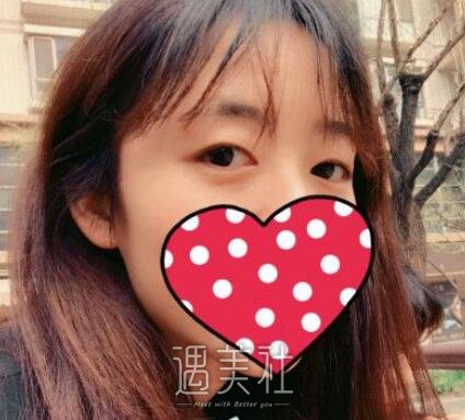 吉大一院整形,科割双眼皮
