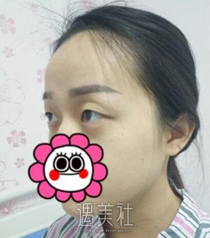 荆州,名韩,做双眼皮