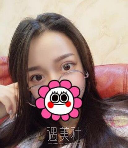 荆州,名韩,做双眼皮