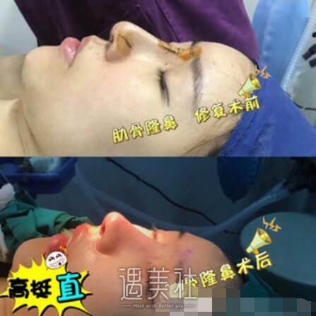 刘云忠