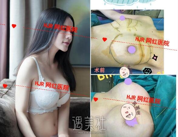 刘云忠