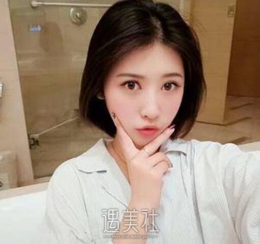 华西医院美容科,肖海涛,双眼皮修复