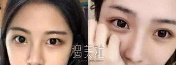 德州,友谊