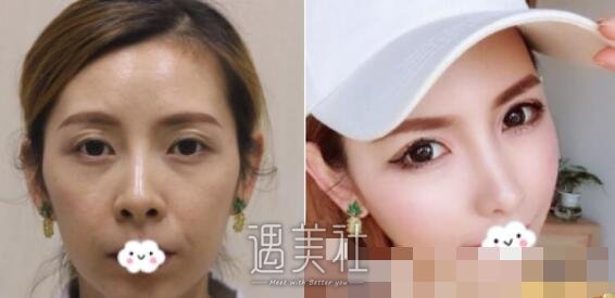 德州,友谊