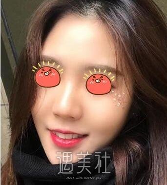 上海,九院,韦敏,磨骨