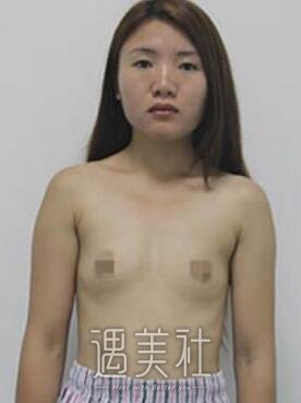 林沸腾,整胸