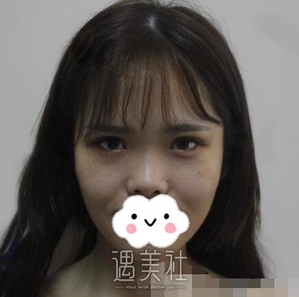 牛勇敢,做鼻子