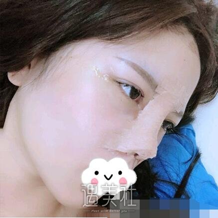牛勇敢,做鼻子