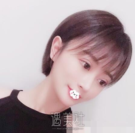 戴传昌，隆鼻