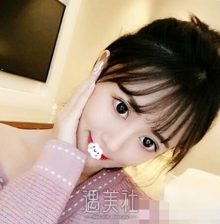 戴传昌，隆鼻