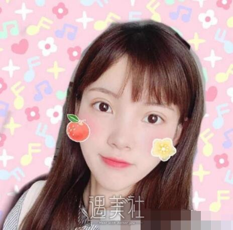 华美,全切双眼皮