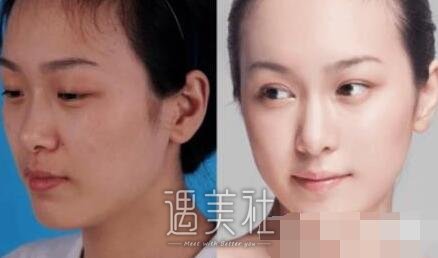 温州附一整形美容科