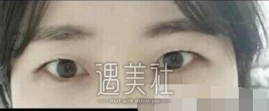 徐州二院,李雪阳