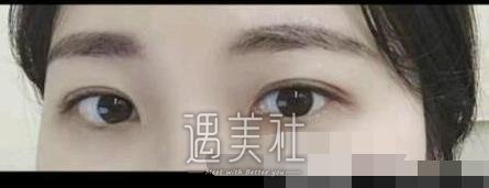 徐州二院,李雪阳