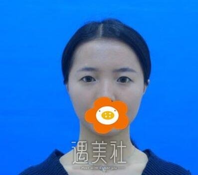 华西,肖海涛