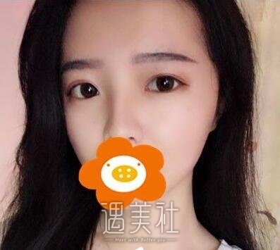 华西,肖海涛