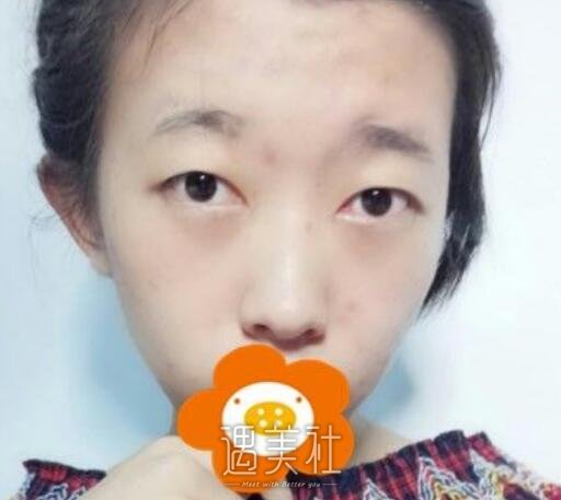 薛志强