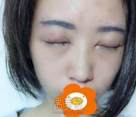 薛志强