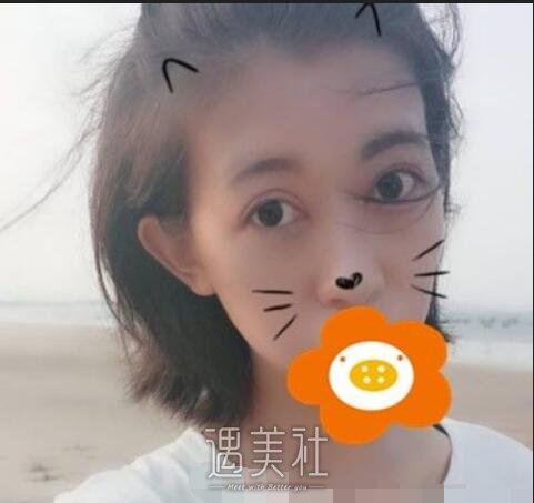 薛志强