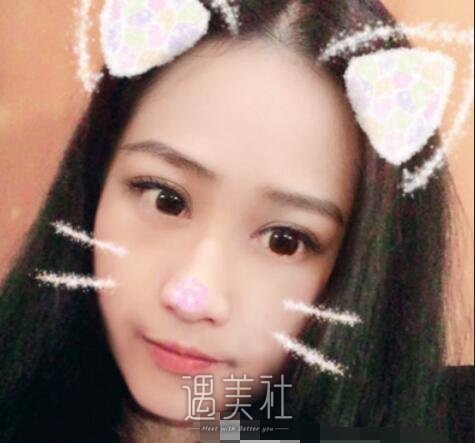 广州,第二人民医院,徐翔