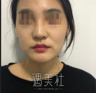 宁波第六医院整形科
