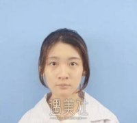 华西医院隆鼻案例：公立三甲医院就没有失败过? width=