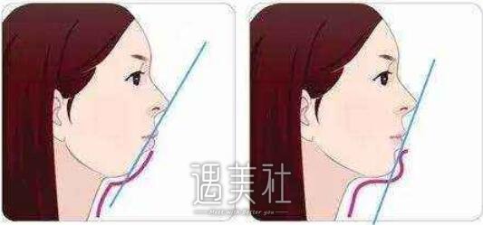 青医附院,正畸