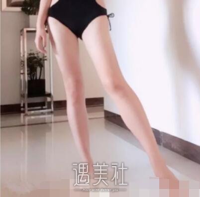 任学会,大腿吸脂