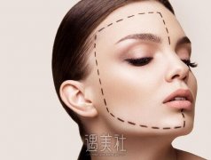 除皱手术多少钱？成都地区是这样收费的~ width=