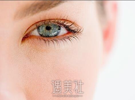 芭比双眼皮