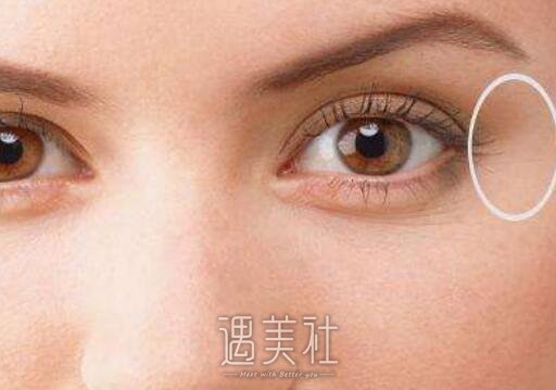 眼睛周围长斑怎么办