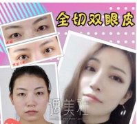 中山三院黄胜华医生怎么样 个人资料 width=