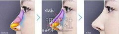 郑大二附院医疗美容科怎么样?2020价格表分享~ width=
