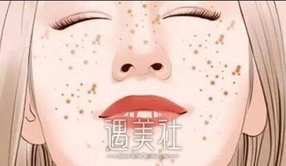 华西医院,激光祛斑