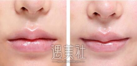上海九院,嘴角上扬