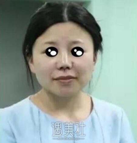 九院，韦敏，隆鼻