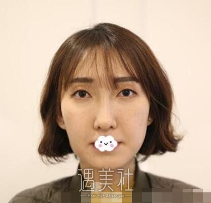 李耐国手术失败案例