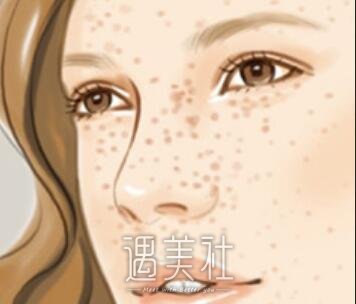 大连皮肤病医院,祛斑