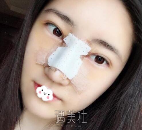 九院,李青峰,隆鼻