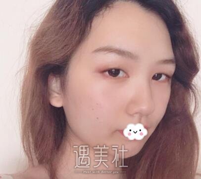 尹宏宇