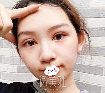 尹宏宇