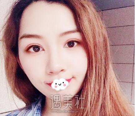 尹宏宇