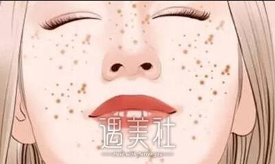 医大一院,激光祛斑
