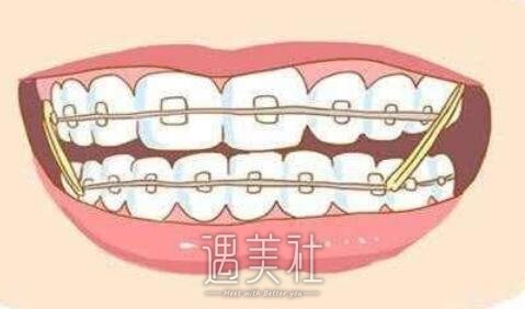 北大口腔,正畸