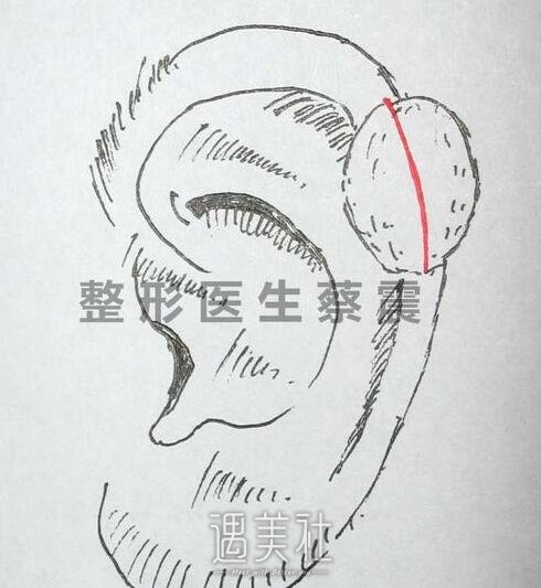 四川省人民医院整形科,蔡震