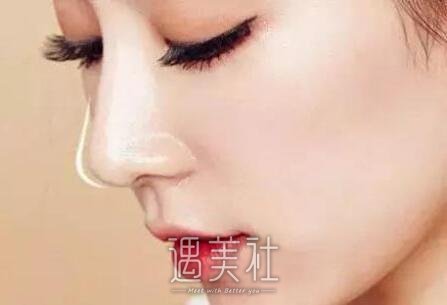 耳软骨鼻子