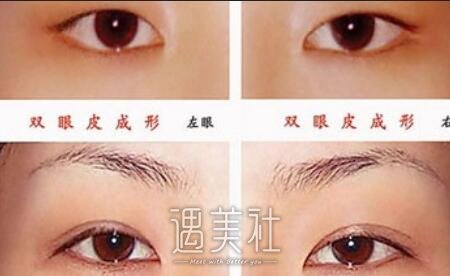 广州,ot